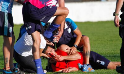 Muñoz y Becerra son bajas en Roncedo tras la agresión desde Toro Club.
